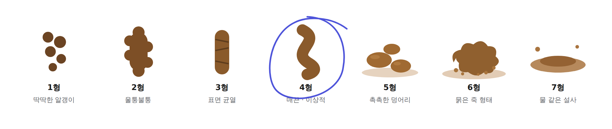 브리스톨 대변 형태 분류 1형부터 7형까지, 4형이 가장 편안한 변