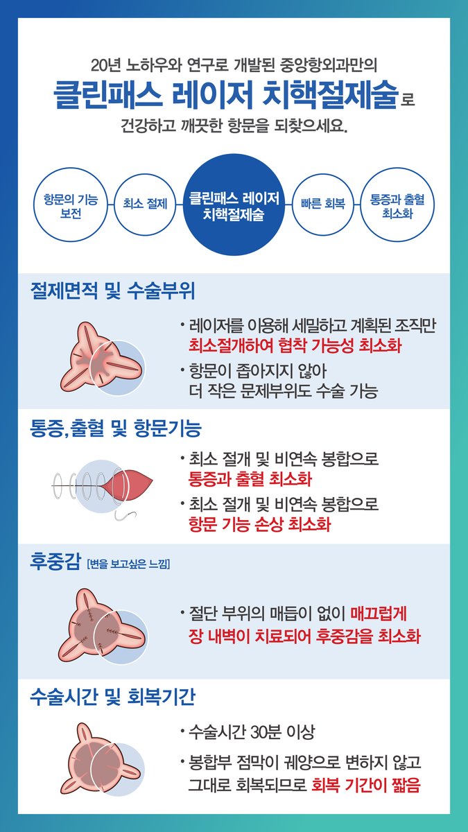 클린패스 레이저 치핵절제술 안내 — 절제 면적과 수술 부위, 통증·출혈, 후중감, 회복 기간을 설명한 병원 안내판