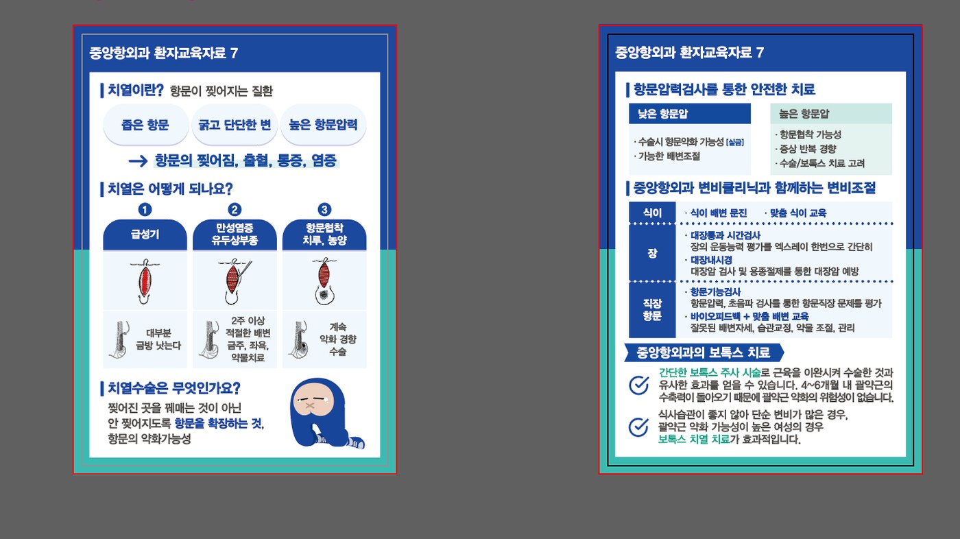 중앙항외과 환자교육자료 — 치열의 원인, 증상, 치료