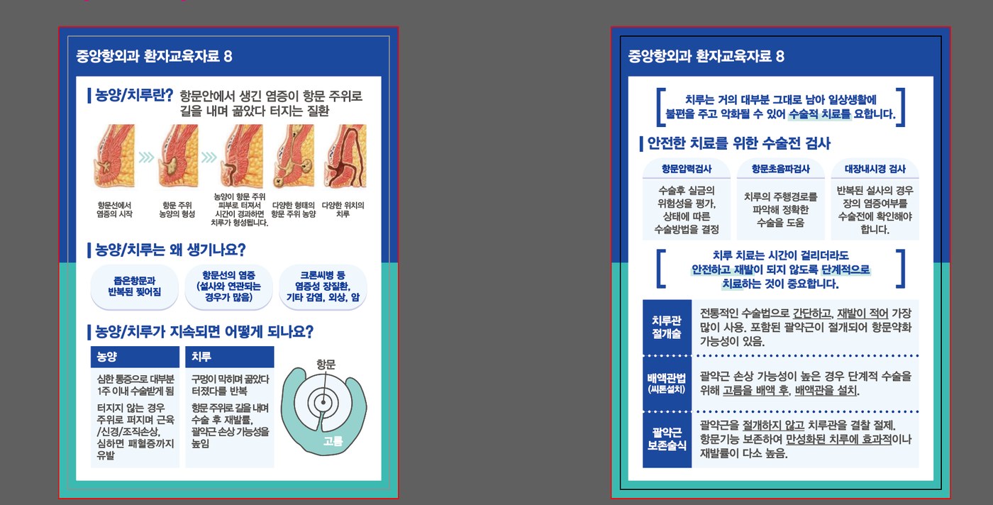 중앙항외과 환자교육자료 — 치루와 항문주위 농양의 원인, 증상, 치료